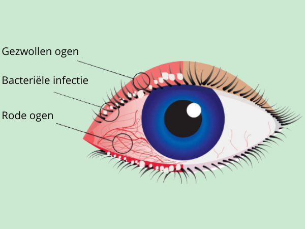blefaritis_rode_ogen